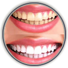 Teeth Whitening Clinton, NJ