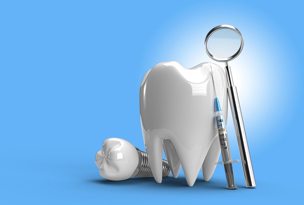 Why Dental Implants are the Ultimate Solution for Missing Teeth