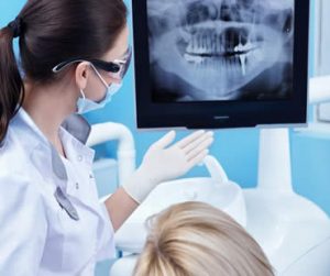 Frequently Asked Questions About Dental Crowns and Bridges